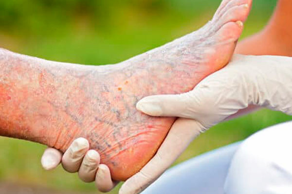 Conheça a importância da podologia geriátrica e onde encontrar